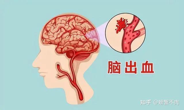 高血压的危害你注意了吗？